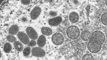 A Massachusetts person became the first US monkeypox case of 2022.