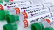 The monkeypox outbreak is getting worse as cases continue to rise.