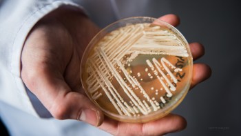 Candida auris, a potentially deadly and drug-resistant fungus, is rapidly spreading in US health care facilities, according to the CDC.