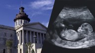 South Carolina lawmakers have proposed a bill to redefine "person" to include the unborn, seeking to link an abortion to an act of homicide.